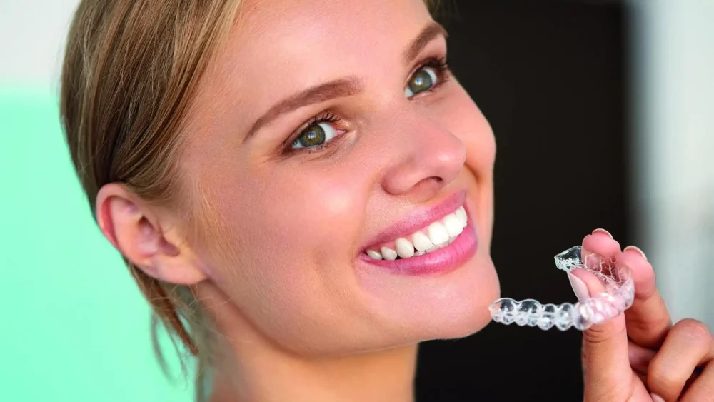 Οφέλη των τιράντες Invisalign